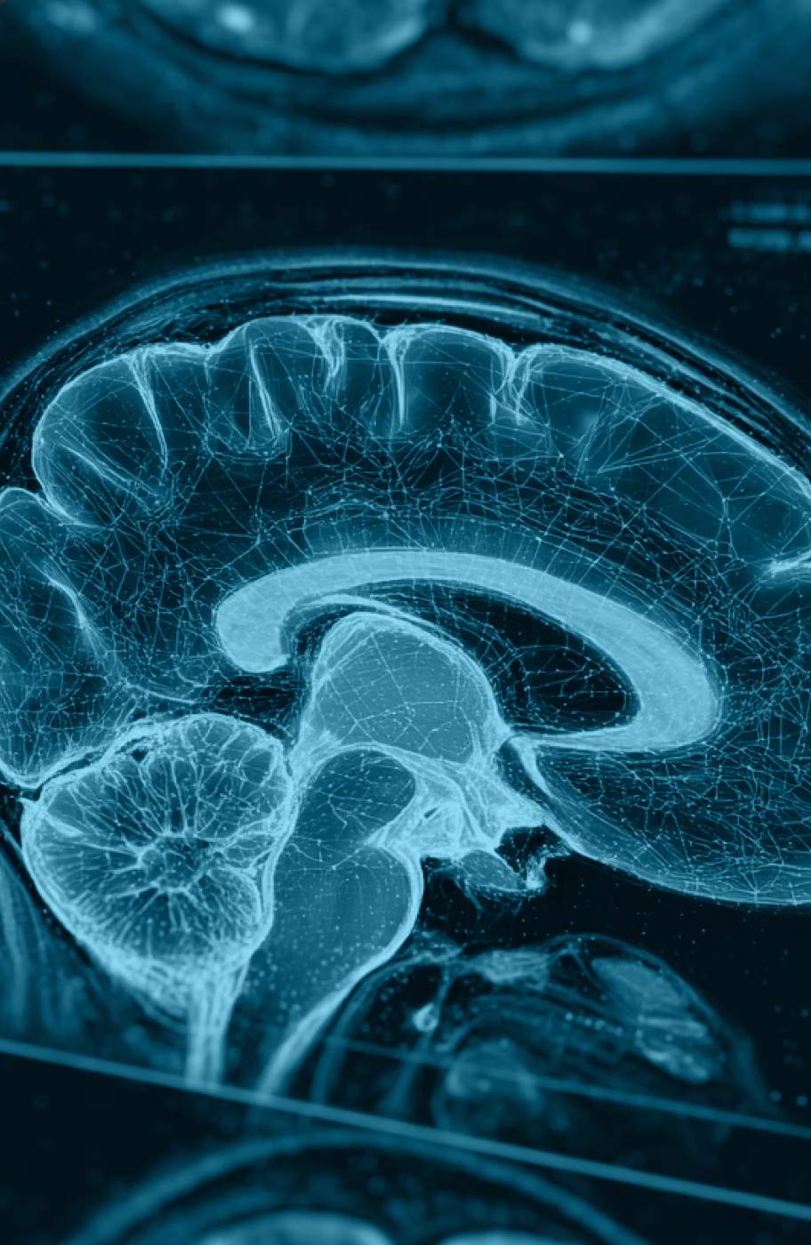 Brain MRI scan visualization representing medical imaging annotation work for AI training and data labeling.